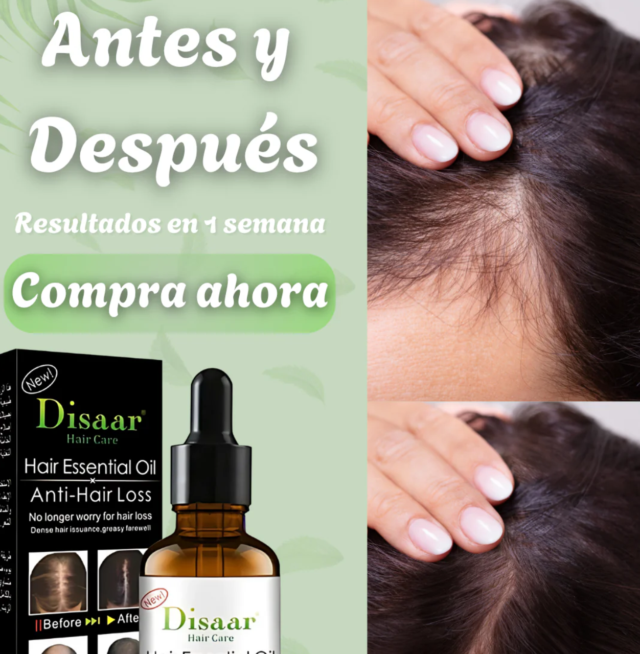 Pack Crecimiento Plus® ACEITE ANTICAÍDA