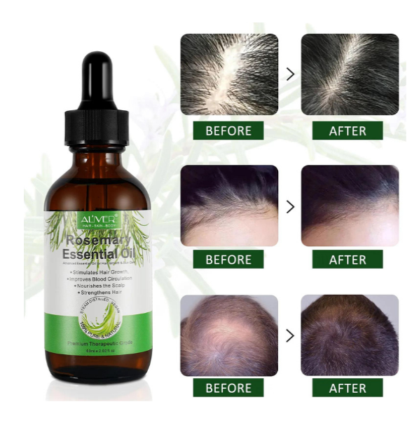 FuerzaCapilar® SERUM FORTALECEDOR