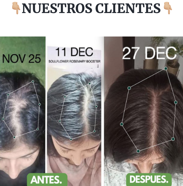 FuerzaCapilar® SERUM FORTALECEDOR