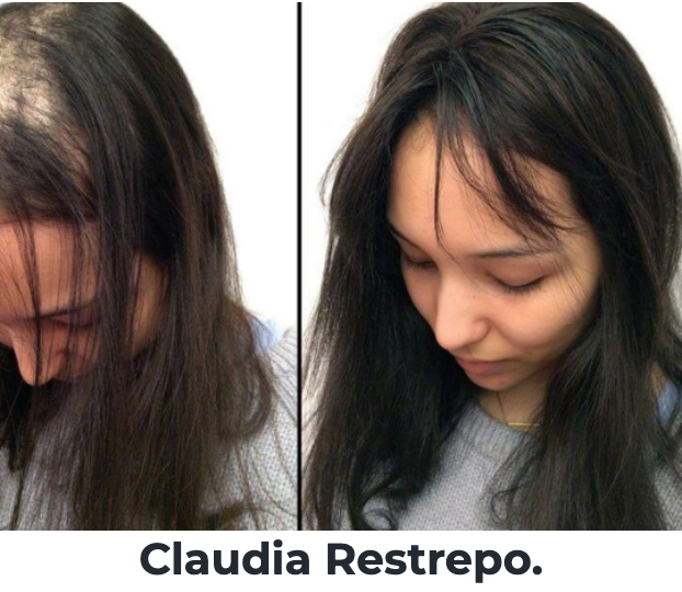 FuerzaCapilar® SERUM FORTALECEDOR